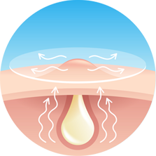 Acne Treatments Lip Doctor expert